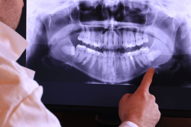 Best Broken or Cracked Tooth Emergency Dentist in Harriman, TN