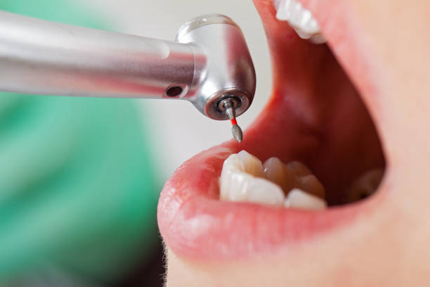 Best Emergency Dental Care for Abscessed Tooth in Harriman, TN